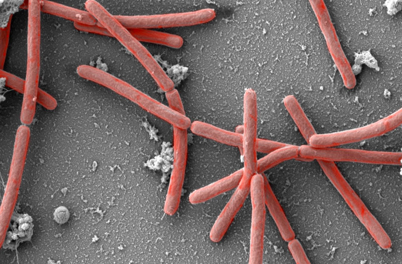 Bild der Mikrobe des Jahres unter Elektronenmikroskop
