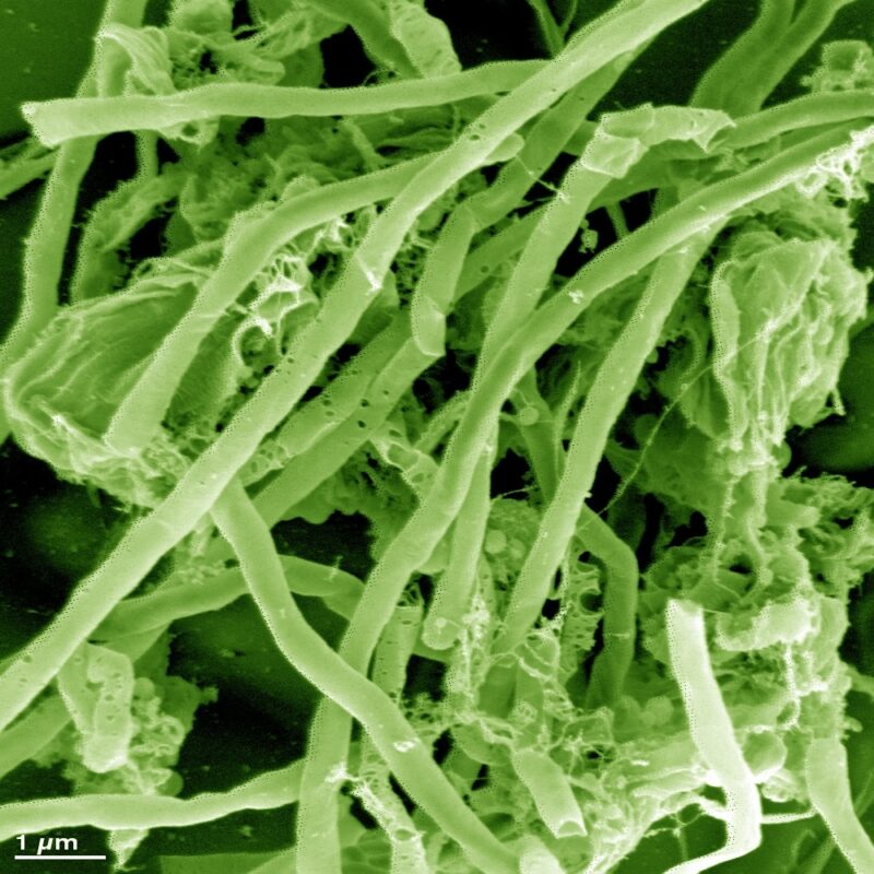 längliche grüne Formen - die Urzeitmikroben Archaeen.